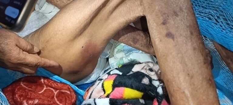 Piden apoyo urgente para adulta mayor de 88 años en Mérida; solicitan intervención de autoridades y sociedad civil